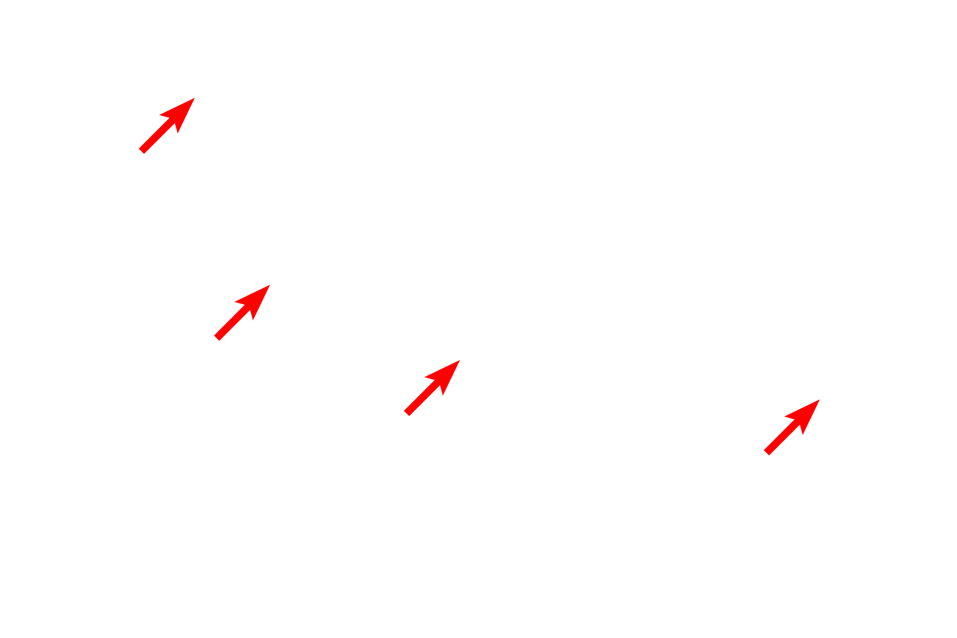  - Heterochromatin <p>This nucleus is mostly euchromatic with a prominent nucleolus. The paler staining areas contain euchromatin. Heterochromatin is located in three regions of the nucleus: (1) immediately beneath the nuclear envelope (marginal or perinuclear chromatin); (2) surrounding the nucleolus (perinucleolar chromatin); and dispersed in clumps throughout the nucleus (karyosomes). All three types are visible in this nucleus. 17,000x</p>
