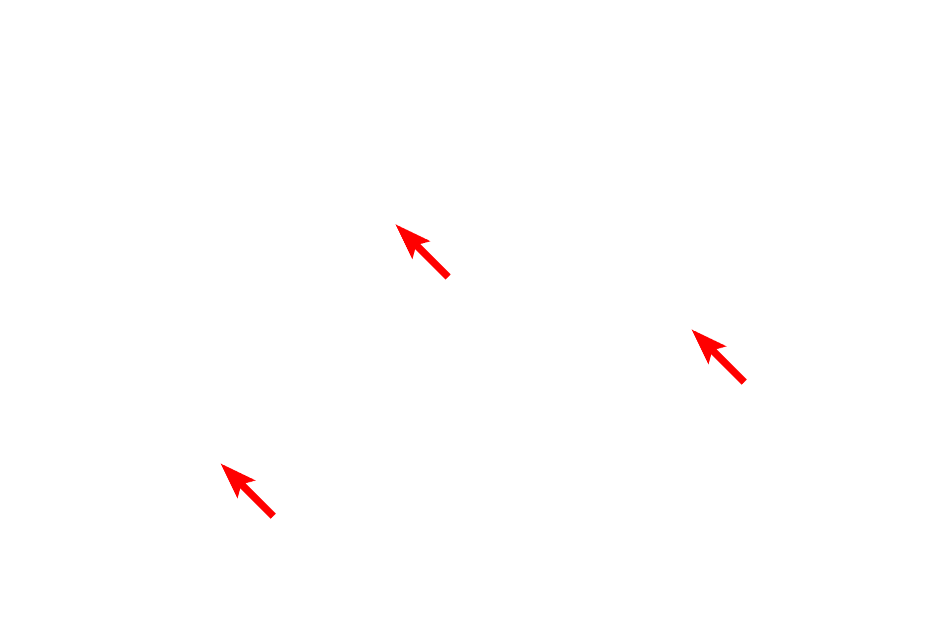 Nuclei <p>These neurons contain a euchromatic nucleus with a well-defined nucleolus. The nucleolus is the site of ribosomal RNA transcription and the initial assembly of ribosomes. Nuclei generally have one nucleolus; however, multiple nucleoli are common in highly active cells, such as liver cells.  1000x</p>
