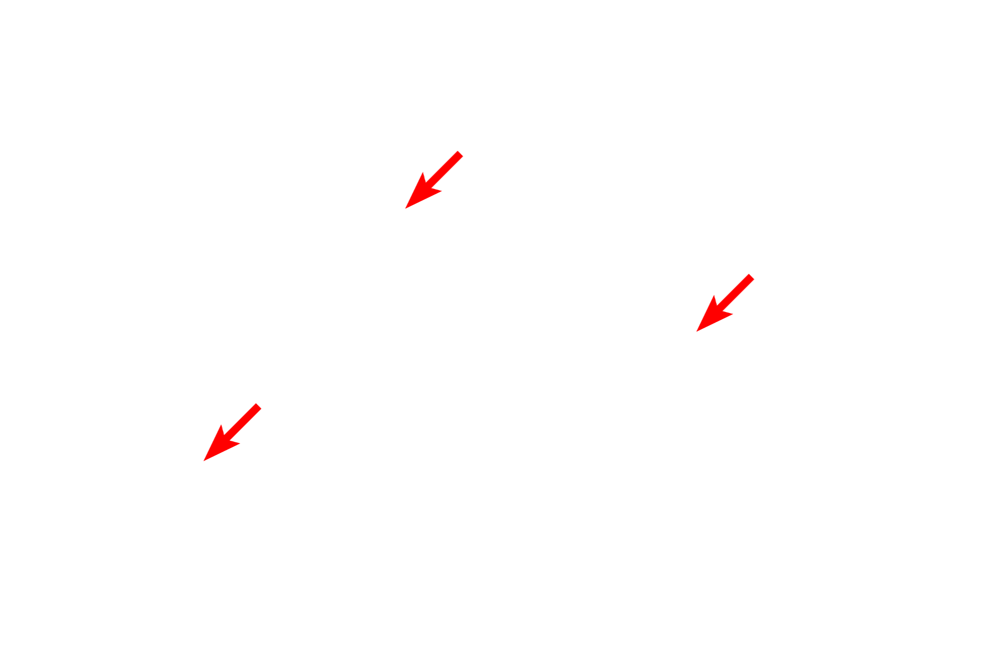  - Nucleoli <p>These neurons contain a euchromatic nucleus with a well-defined nucleolus. The nucleolus is the site of ribosomal RNA transcription and the initial assembly of ribosomes. Nuclei generally have one nucleolus; however, multiple nucleoli are common in highly active cells, such as liver cells.  1000x</p>
