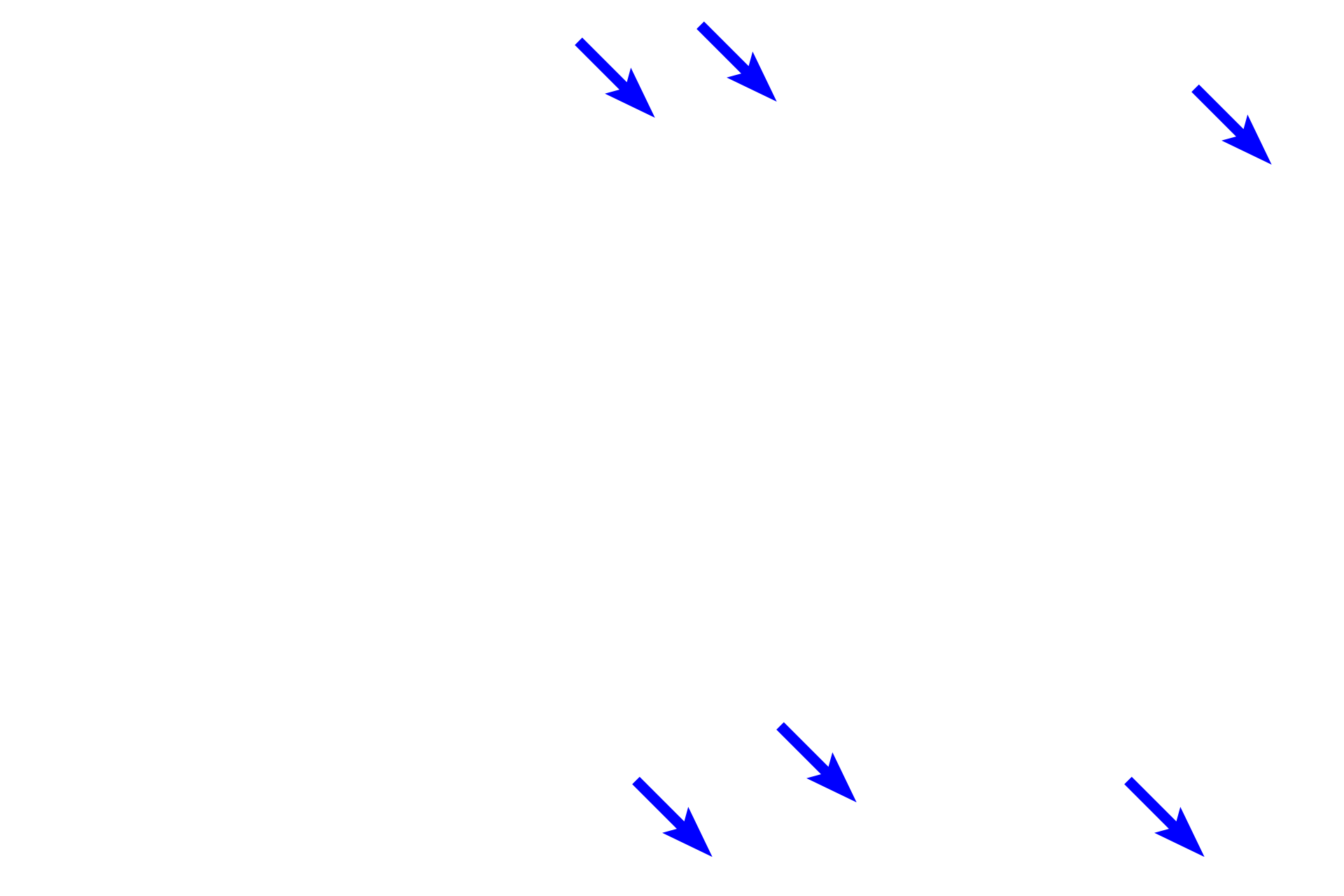 Bone-cartilage interface > <p>The ends of long bones are covered by articular cartilage, formed of hyaline cartilage, providing a smooth, glassy surface that allows the ends of the bones to move easily on each other. This type of articulation is called a synovial joint. Articular cartilages, which are not covered by periosteum, are separated by a fluid-filled synovial space. A thin layer of compact bone lies beneath the cartilage.  10x, 800x  </p>
