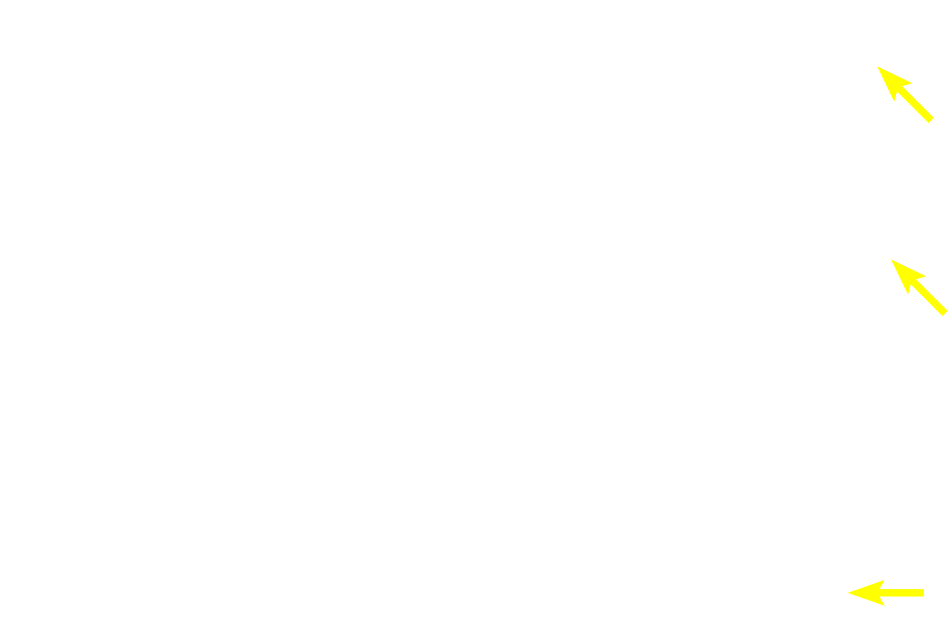  - Howship's lacunae <p>Osteoclasts are derived from monocyte/macrophage stem cells in the bone marrow and arrive in the osteogenic layer via the blood stream. They are not resident cells of the periosteum. Osteoclast activity produces shallow depressions in the bone called Howship’s lacunae.</p>
