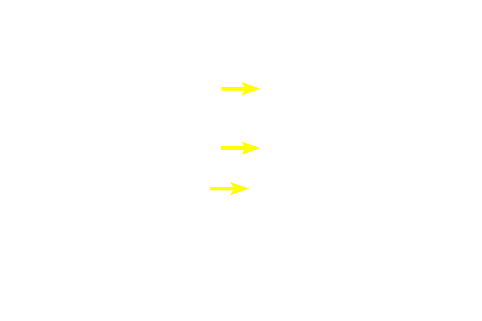  - Osteoblasts <p>Regions of bone deposition are indicated by the presence of osteoblasts on the surface of existing bone. Osteoblasts secrete osteoid, the organic matrix of bone, which rapidly become mineralized with hydroxyapatite. Bone deposition by the periosteum is an example of appositional bone growth by intramembranous ossification that occurs at sites of bone growth and healing following fracture. </p>
