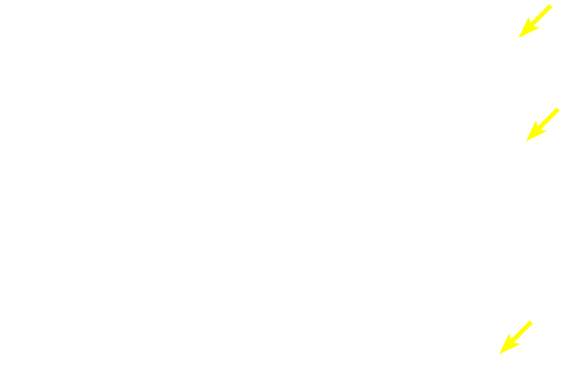  - Osteoclasts >  <p>Osteoclasts are derived from monocyte/macrophage stem cells in the bone marrow and arrive in the osteogenic layer via the blood stream. They are not resident cells of the periosteum. Osteoclast activity produces shallow depressions in the bone called Howship’s lacunae.</p>
