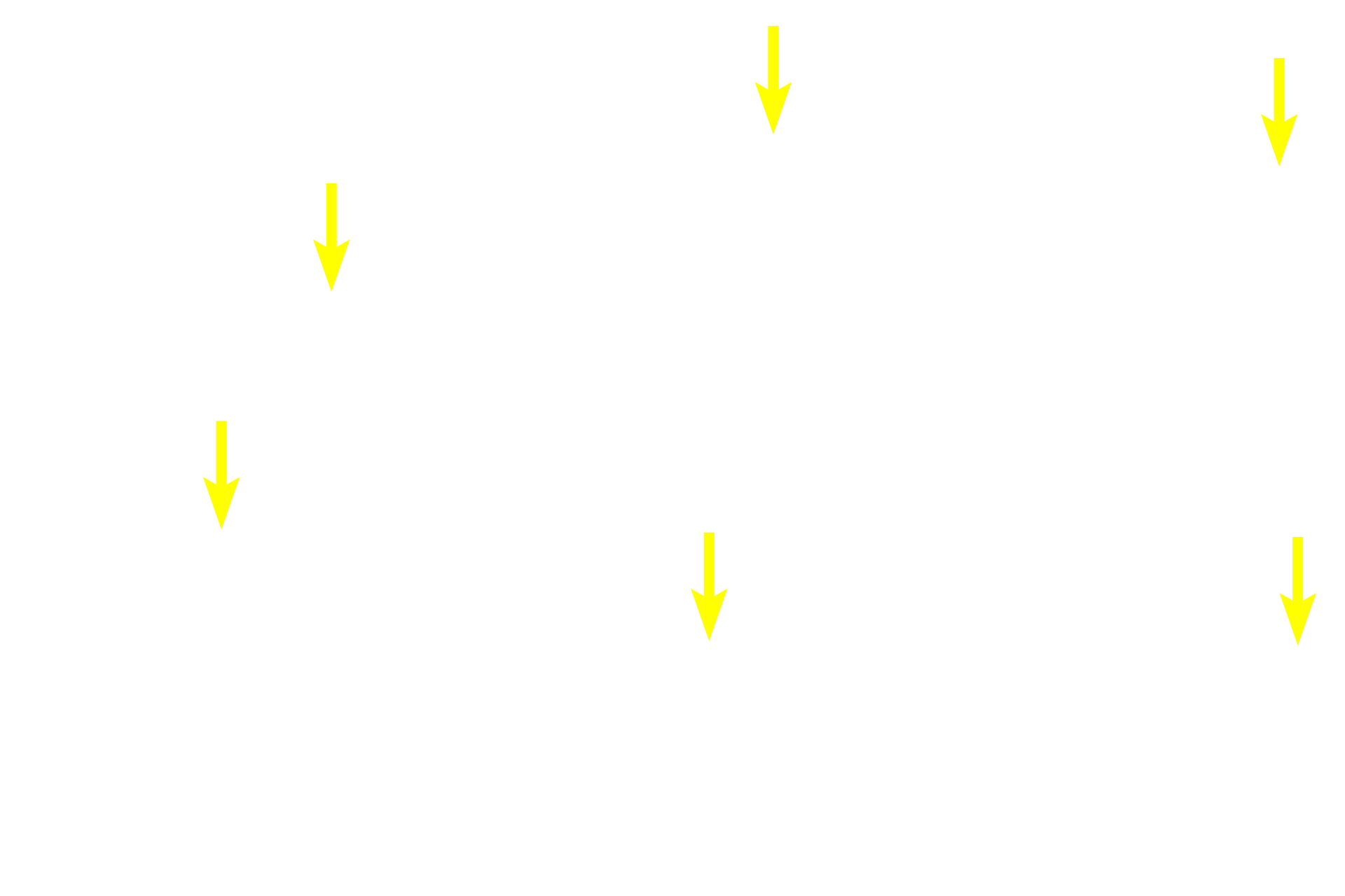  - Osteocytes <p>The periosteum covers the outer surface of bones, except where articular cartilages are present. The periosteum consists of an outer fibrous layer of dense connective tissue and an inner osteogenic layer. The osteogenic layer varies considerably depending on its functional state, reflecting regions of relative inactivity, bone deposition, or bone resorption and remodeling. The periosteum is also well vascularized and innervated.  800x </p>
