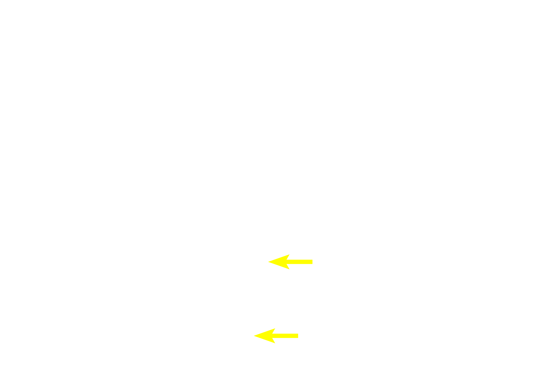  - Bone lining cells <p>Regions of bone deposition are indicated by the presence of osteoblasts on the surface of existing bone. Osteoblasts secrete osteoid, the organic matrix of bone, which rapidly become mineralized with hydroxyapatite. Bone deposition by the periosteum is an example of appositional bone growth by intramembranous ossification that occurs at sites of bone growth and healing following fracture. </p>
