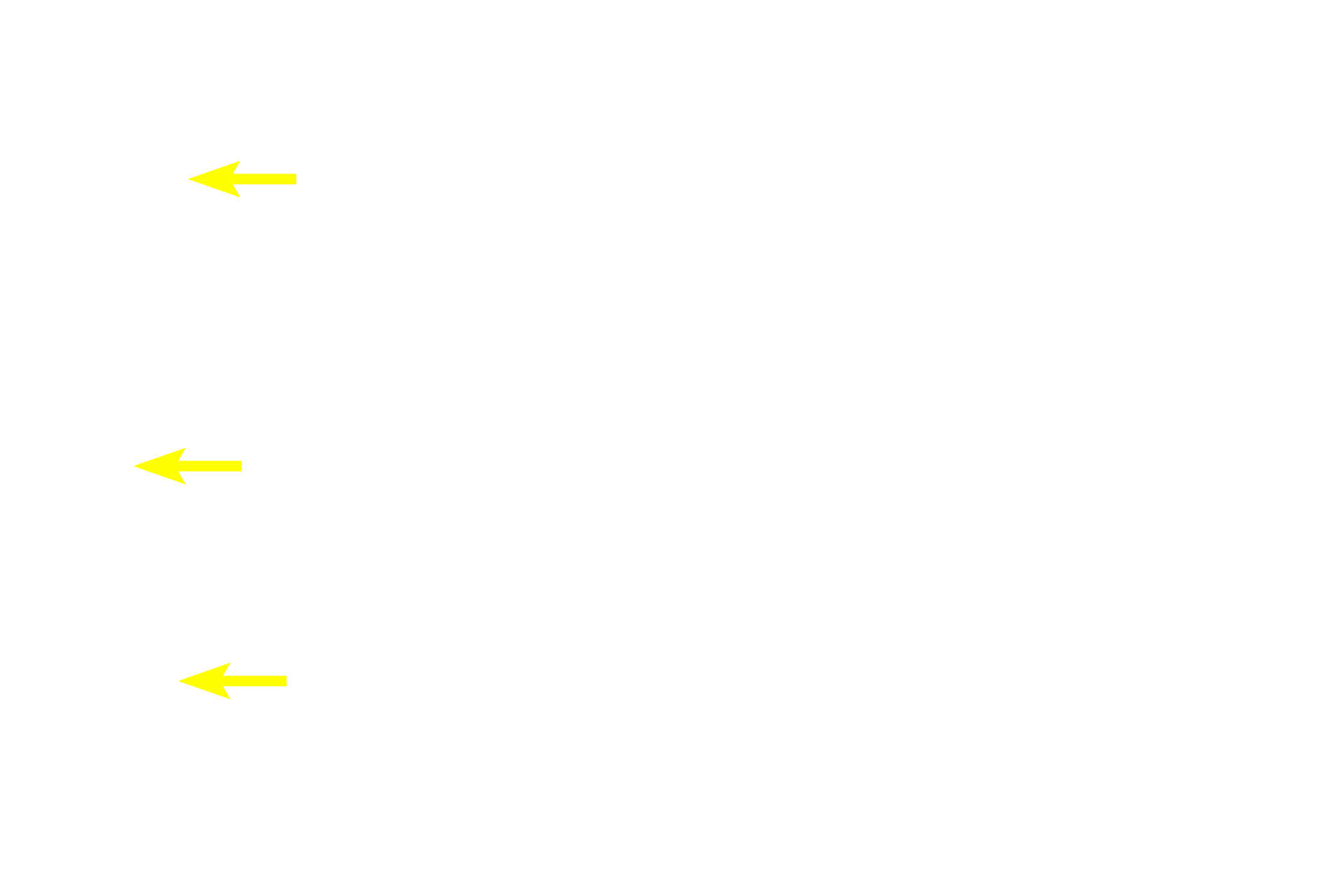  - Progenitor and lining cells <p>At sites where neither bone deposition nor resorption are occurring, the periosteum is relatively inactive, consisting mostly of osteoprogenitor cells and bone lining cells. Both cell types have a spindle shape and thus difficult to distinguish from each other. </p>
