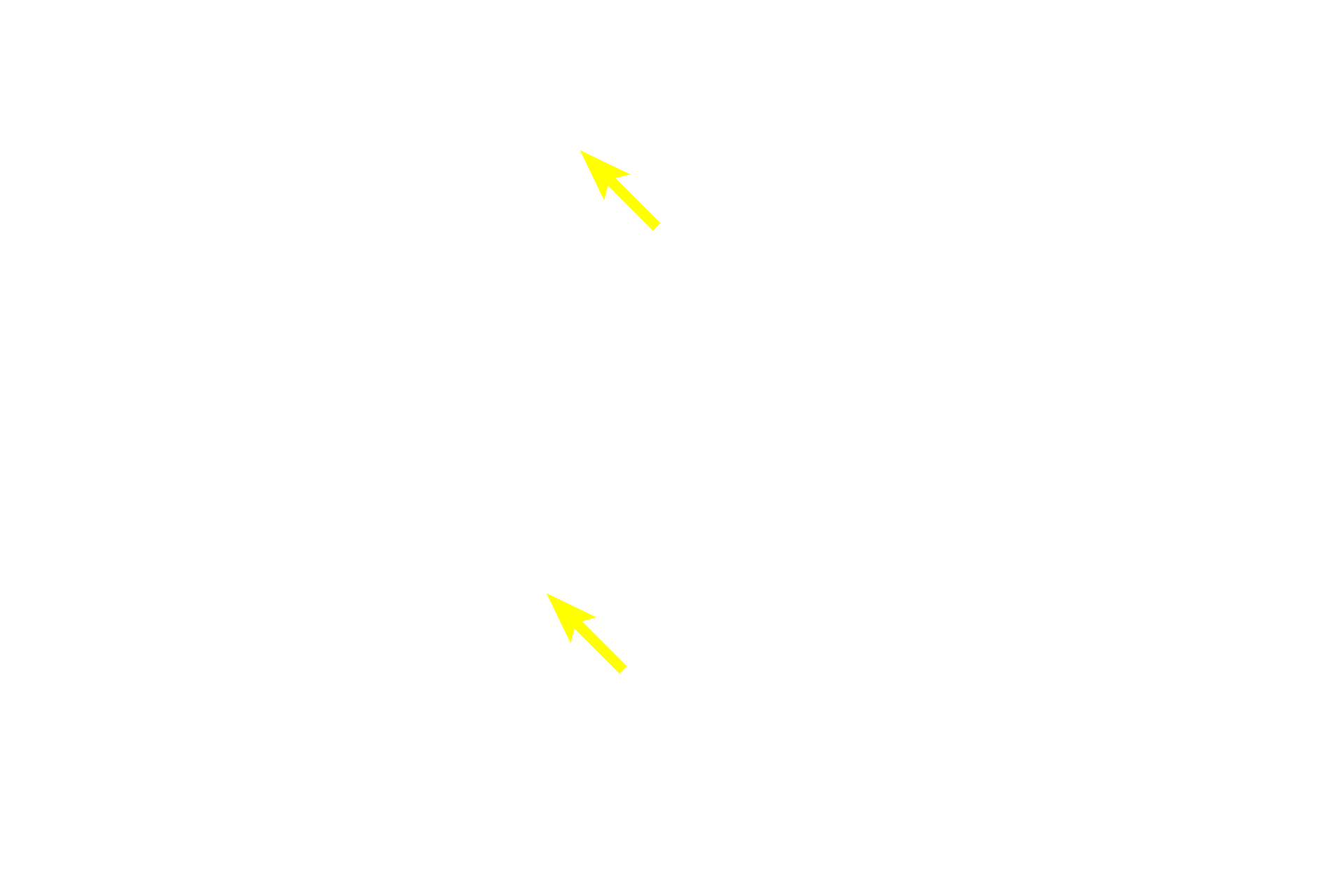  - Muscle insertion >  <p>The fibrous layer of the periosteum also serves at the site of muscle and ligament attachment.  Collagen fibers from the muscle tendon and ligament blend with those of the fibrous layer of the periosteum and also extend into the bone matrix as Sharpey’s fibers.</p>
