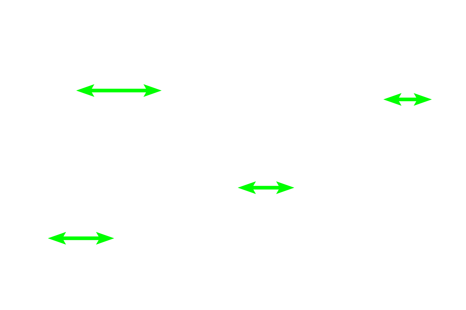 Spicules <p>A region of developing spongy bone shows spicules composed of woven bone surrounded by mesenchymal connective tissue. Osteocytes within the spicules are randomly arranged and the matrix appears amorphous, not composed of lamellae. The matrix of these spicules will gradually be remodeled into regularly arranged, flattened lamellae with osteocytes orderly arranged between them.  400x</p>
