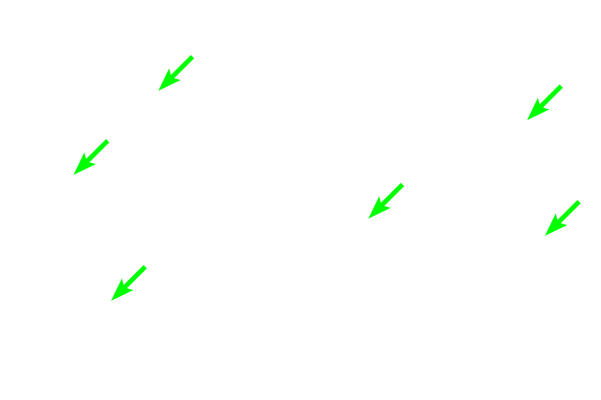  - Osteocytes <p>A region of developing spongy bone shows spicules composed of woven bone surrounded by mesenchymal connective tissue. Osteocytes within the spicules are randomly arranged and the matrix appears amorphous, not composed of lamellae. The matrix of these spicules will gradually be remodeled into regularly arranged, flattened lamellae with osteocytes orderly arranged between them.  400x</p>
