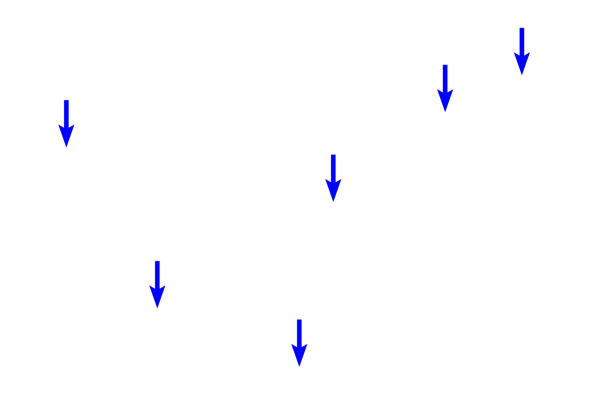  - Endosteum <p>A region of developing spongy bone shows spicules composed of woven bone surrounded by mesenchymal connective tissue. Osteocytes within the spicules are randomly arranged and the matrix appears amorphous, not composed of lamellae. The matrix of these spicules will gradually be remodeled into regularly arranged, flattened lamellae with osteocytes orderly arranged between them.  400x</p>
