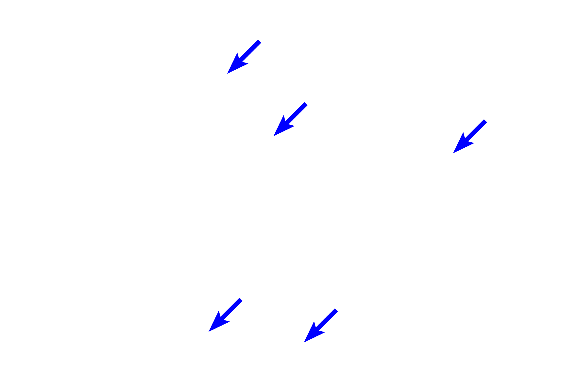  - Mesenchymal fibroblasts <p>A region of developing spongy bone shows spicules composed of woven bone surrounded by mesenchymal connective tissue. Osteocytes within the spicules are randomly arranged and the matrix appears amorphous, not composed of lamellae. The matrix of these spicules will gradually be remodeled into regularly arranged, flattened lamellae with osteocytes orderly arranged between them.  400x</p>
