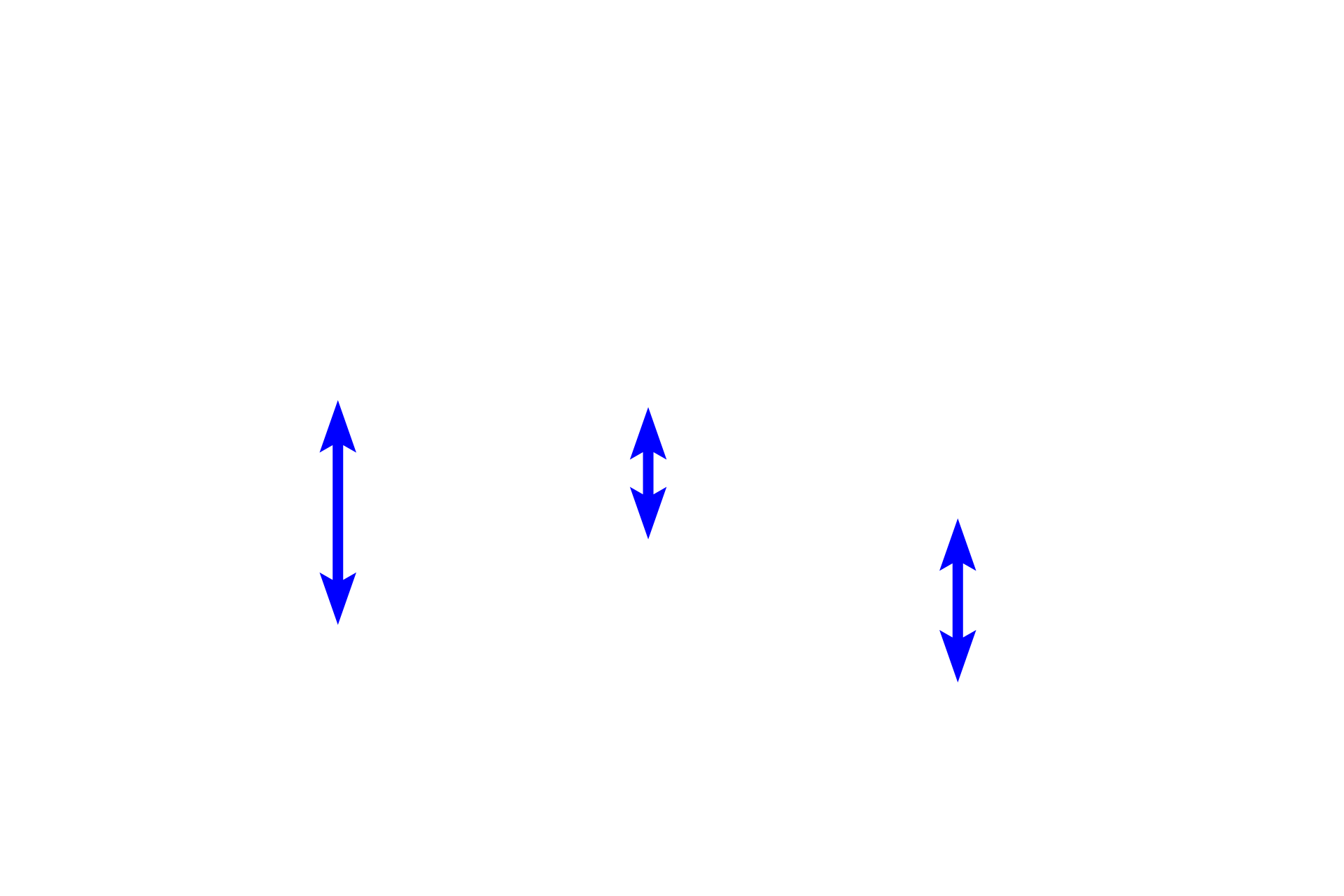  - Blood vessels <p>A region of developing spongy bone shows spicules composed of woven bone surrounded by mesenchymal connective tissue. Osteocytes within the spicules are randomly arranged and the matrix appears amorphous, not composed of lamellae. The matrix of these spicules will gradually be remodeled into regularly arranged, flattened lamellae with osteocytes orderly arranged between them.  400x</p>
