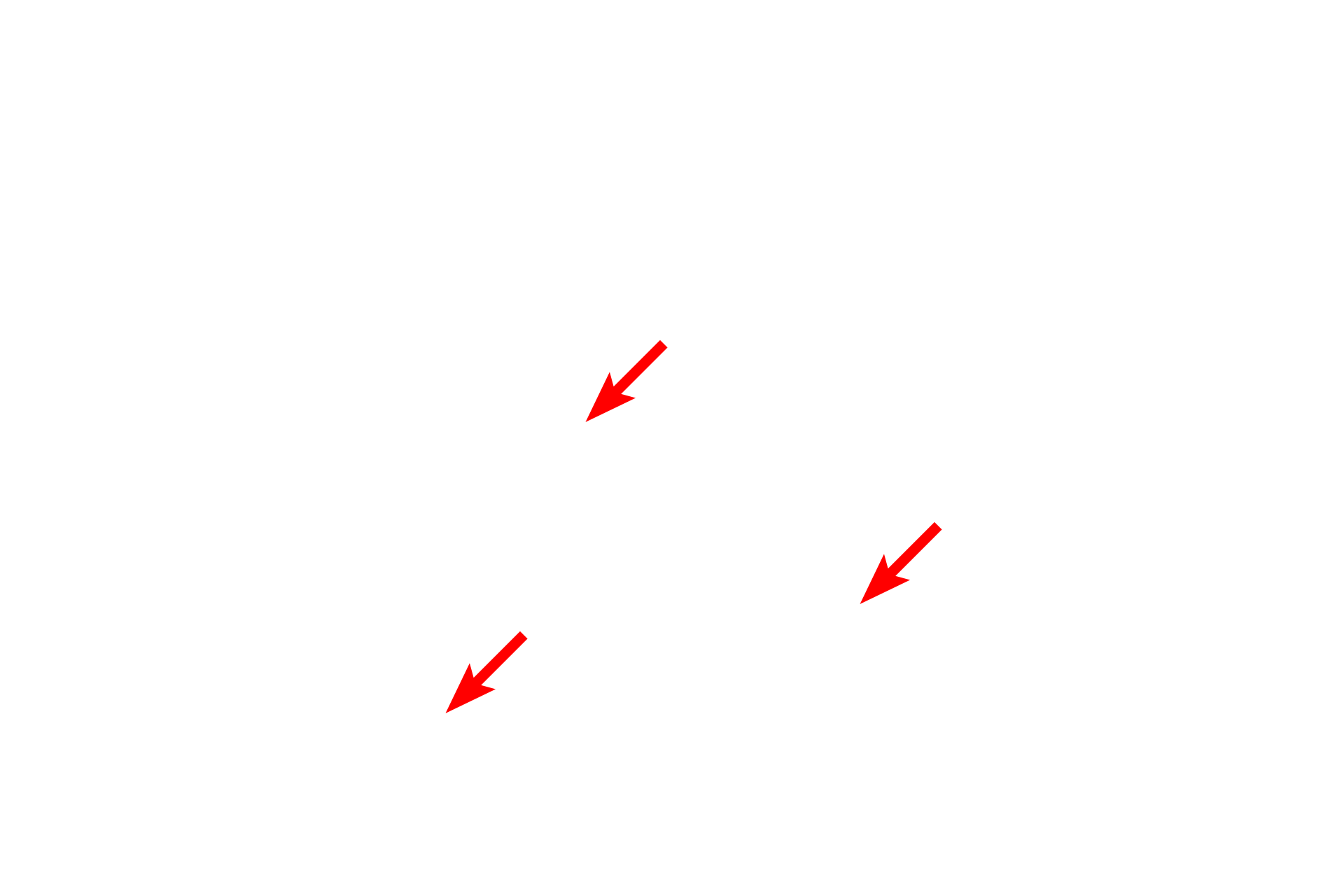 Basal cells <p>The lining epithelium of the trachea demonstrates a pseudostratified epithelium with cilia and gland cells (goblet cells). In a pseudostratified epithelium, all cells rest on the basement membrane, though not all reach the free surface. This variation in height, and thus position of the nuclei, give the impression of a stratified epithelium.  1000x</p>
