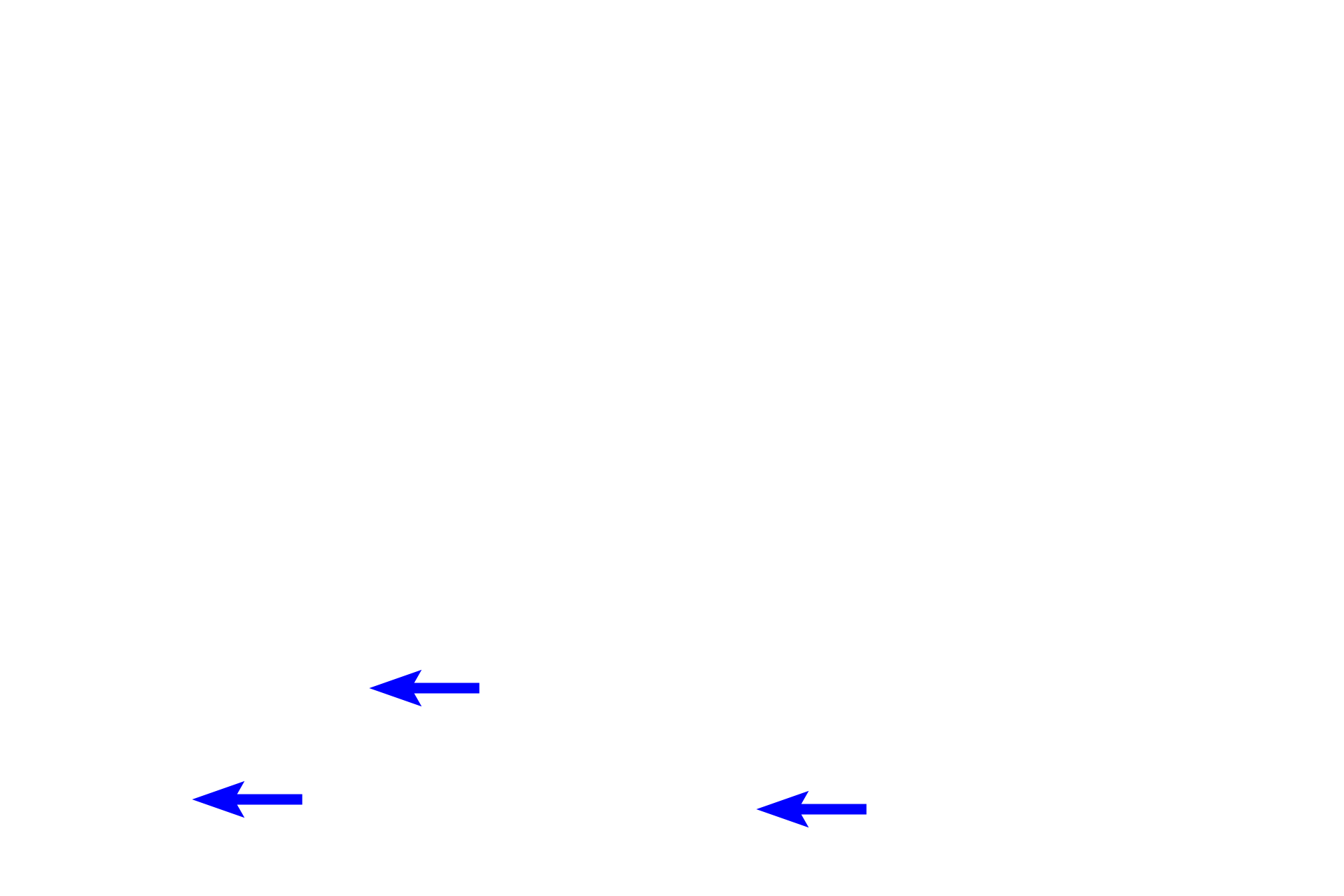  - Basal layer cells <p>This image demonstrates the transition of epithelial cells from proliferating, cuboidal cells at the basement membrane to squamous cells at the surface. The multiple cell layers of this stratified moist epithelium provide protection for underlying tissues from surface friction and trauma.  Esophagus, 400x</p>
