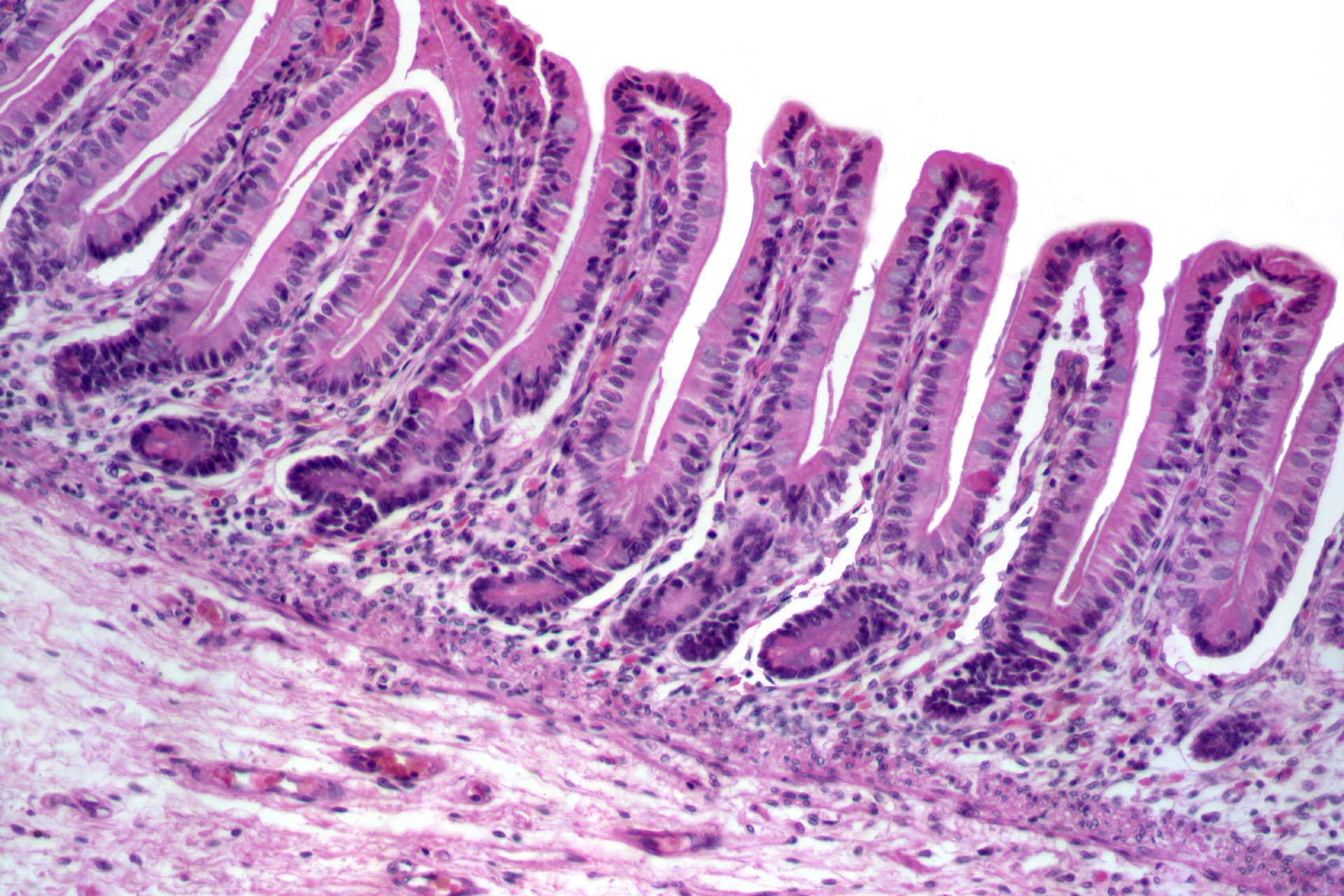 Quartafeira Senhor Entreter Histology Of Gastrointestinal Tract 