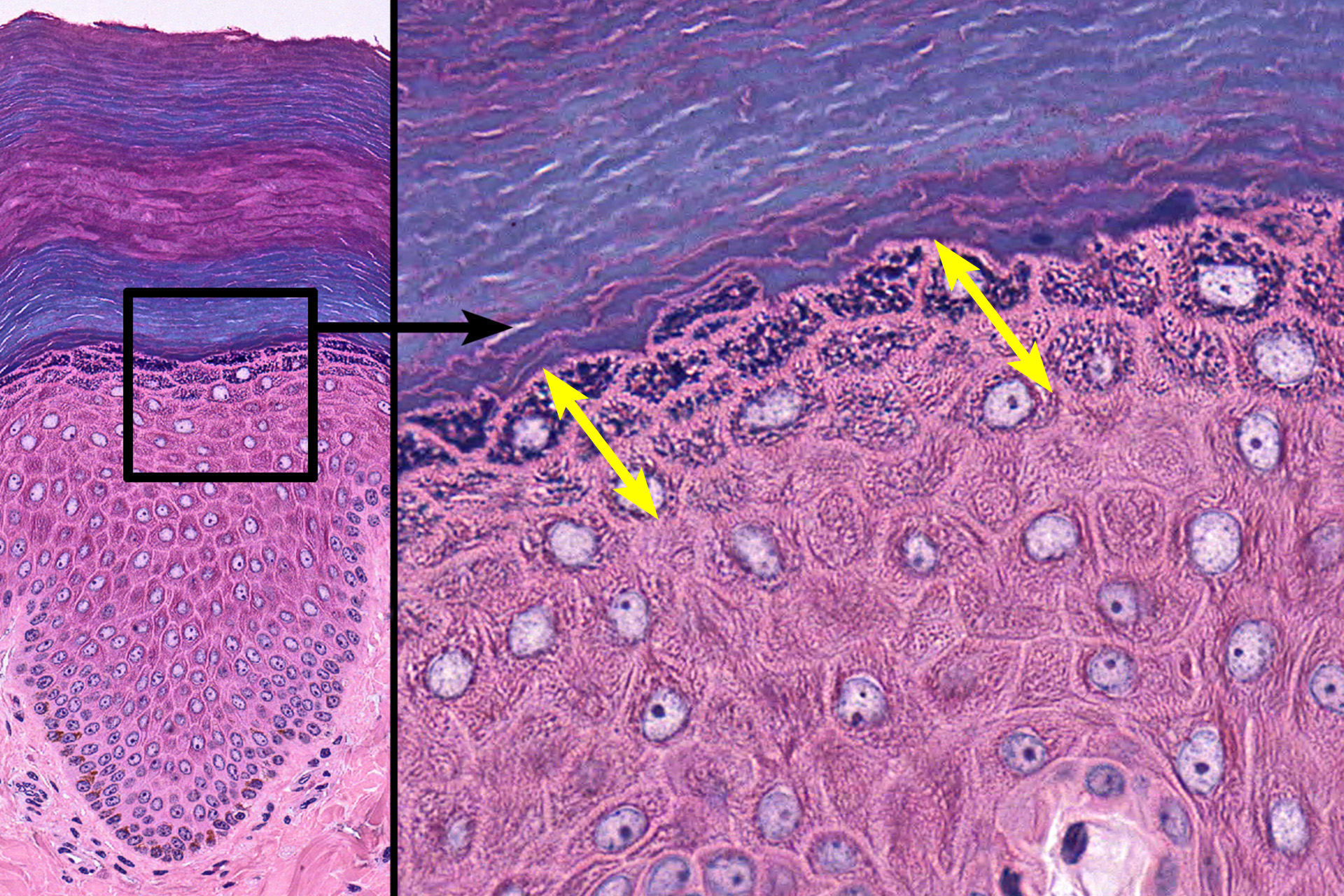layers of epidermis histology